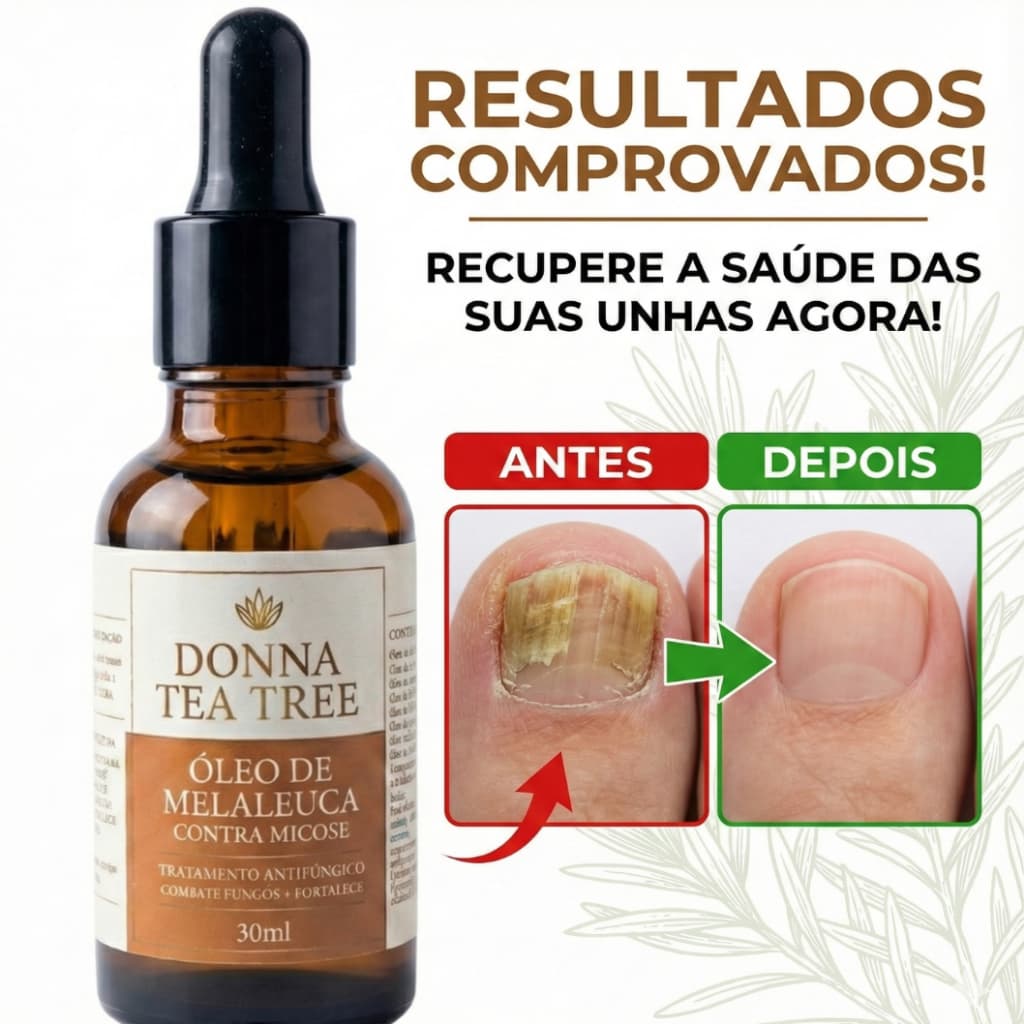 Óleo de Melaleuca Tea Tree Donna 30ml Antifúngico Natural para Unhas, Pele e Micose