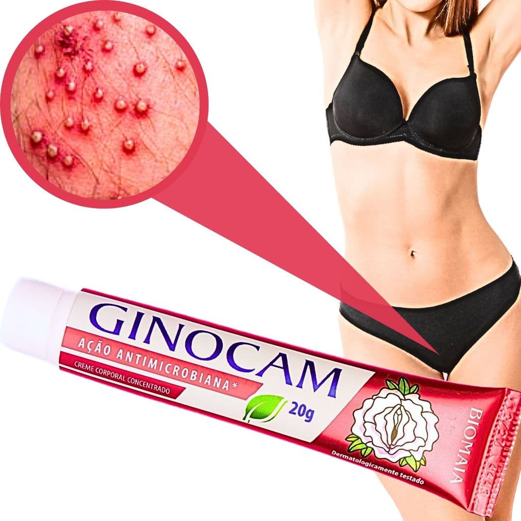 Pomada Doenças Femininas Partes Intimas Vaginose Herpes Neutra