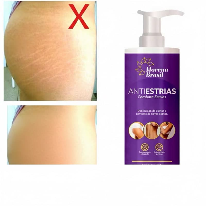 Creme Anti Estrias Morena Brasil 200g | Reduz Estrias, Hidrata e Melhora a Elasticidade da Pele
