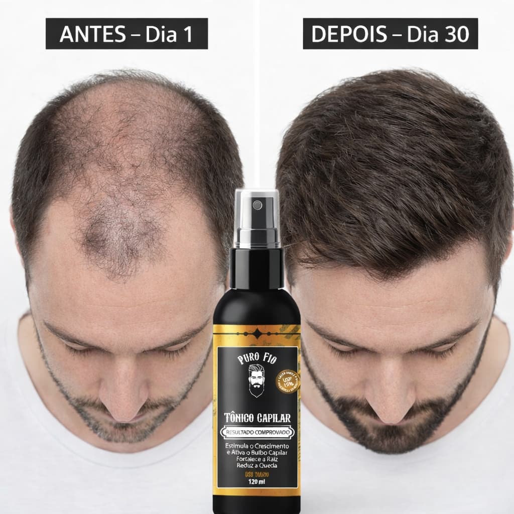 Tônico Capilar 15% Anti Queda Serum de Crescimento Poderoso Barba Cabelo Sobrancelha Bigode Kit f