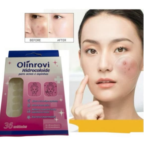 Adesivo Secativo para Espinhas Hidrocoloide Invisível – Absorve Acne Cravos – 36 Unidades