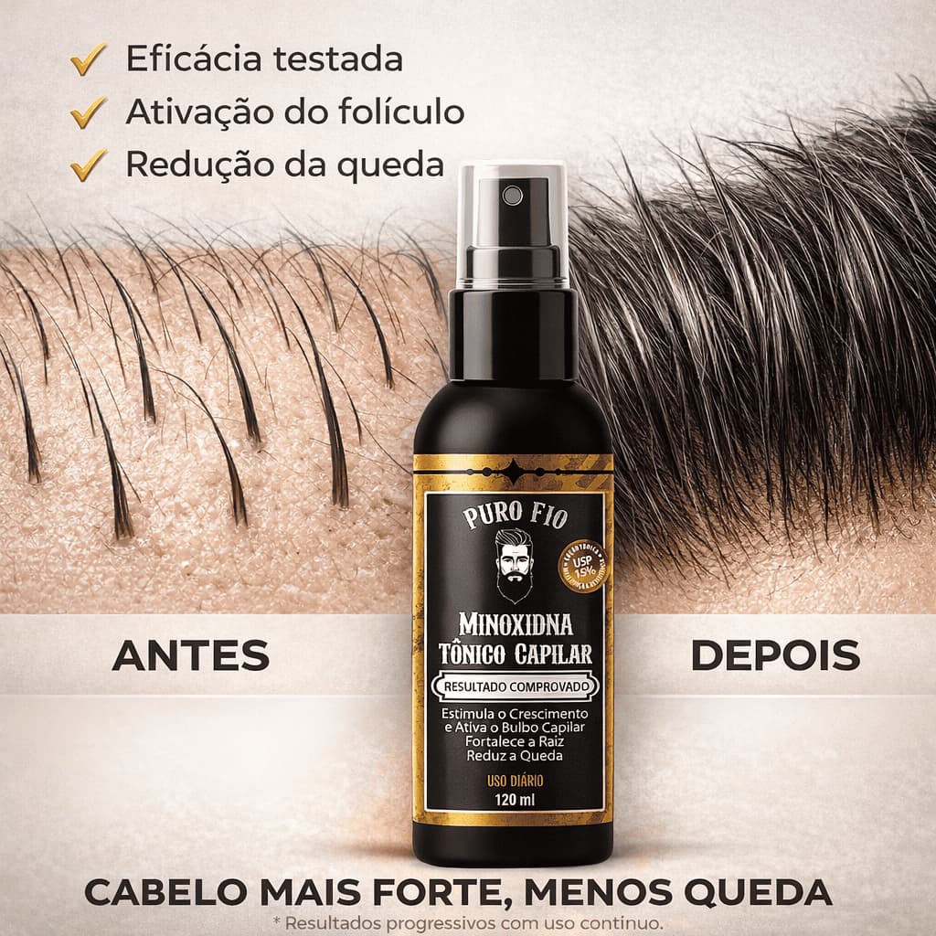 Kits PRO BARBER Tônico Capilar antiqueda 1 a 5 unidades 120ml Crescimento Cabelo Barba Bigode Sobrancelha Envio Imediato