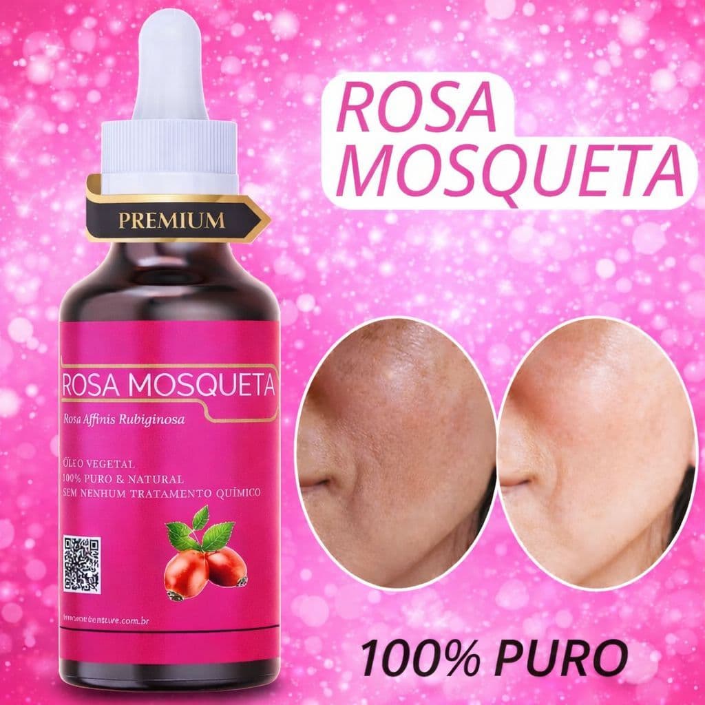 Óleo de Rosa Mosqueta - Pele, Clareador Natural 100% Puro - 30ML - Envio Imediato