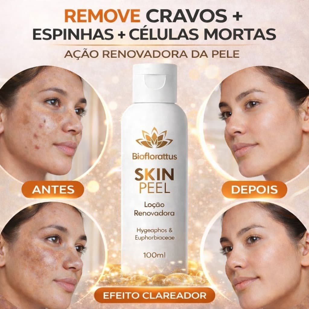 Removedor de Cravos e Espinhas Facial | Limpeza Profunda | Anti Oleosidade | Tratamento de Pele | Skin Peel Bioflorattus