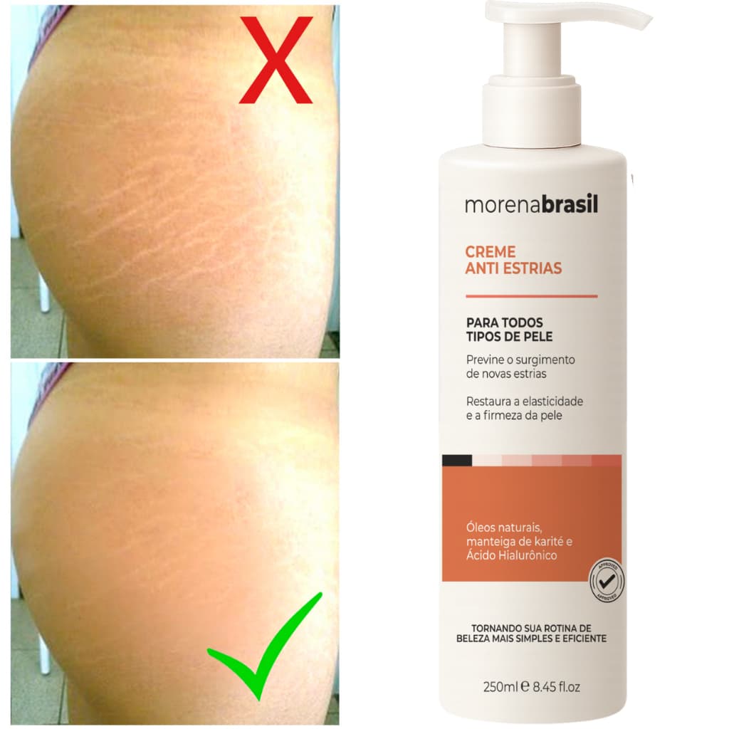 🦵🏽 Creme Anti-Estrias Morena Brasil 🧡 Ação Poderosa com Colágeno e Elastina!!