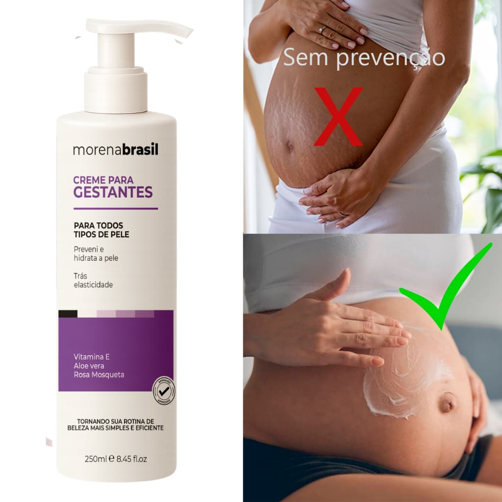 Creme Prevenção de Estrias na Gravidez: Cuidado Completo Pré e Pós-Gestação
