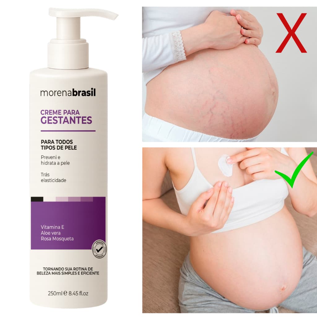 💜Creme Prevenção de Estrias 🤰🏽 Segurança e Hidratação para Mamães!