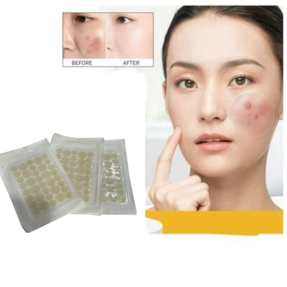 108uni Adesivo Secativo para Espinhas Hidrocoloide Invisível – Absorve Acne Cravos