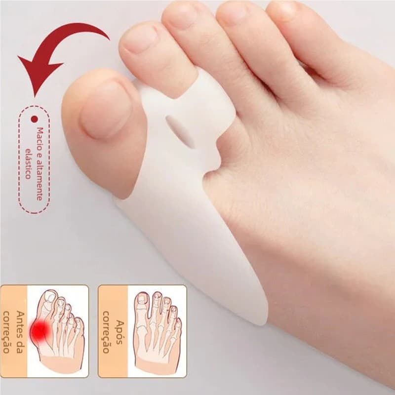 Protetor de Joanete de Silicone Ortopédico Pé Macio Confortável Par Corretor Hallux Valgus Palmilha