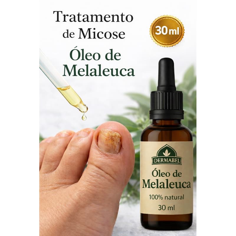 Óleo de Melaleuca 30ml Combate Micose Unhas Candidiase, Acne e Fortalece  Cabelos Dermabel Tea Tree