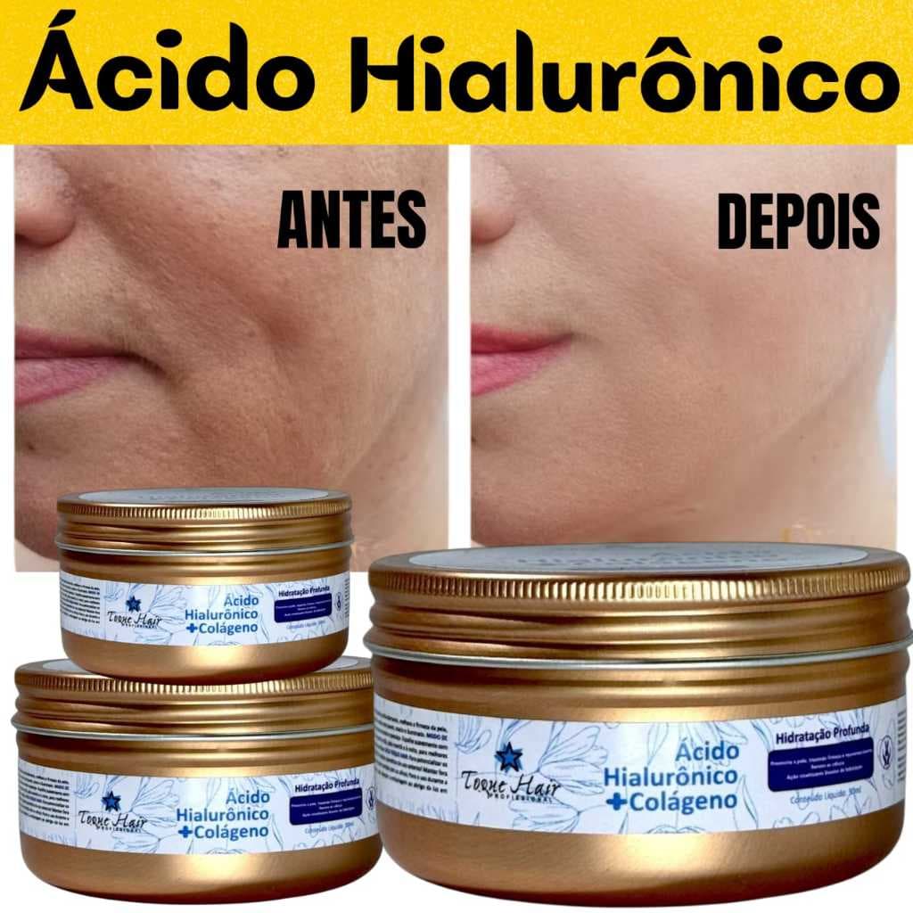 Creme Para O Rosto  Ácido Hialurônico + Colágeno – Hidratação Profunda e Pele Renovada!