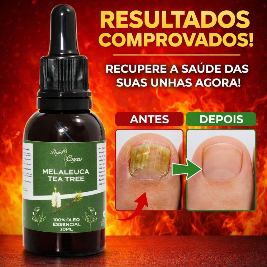 Óleo Essencial de Melaleuca Conta gotas 100% puro 30ML