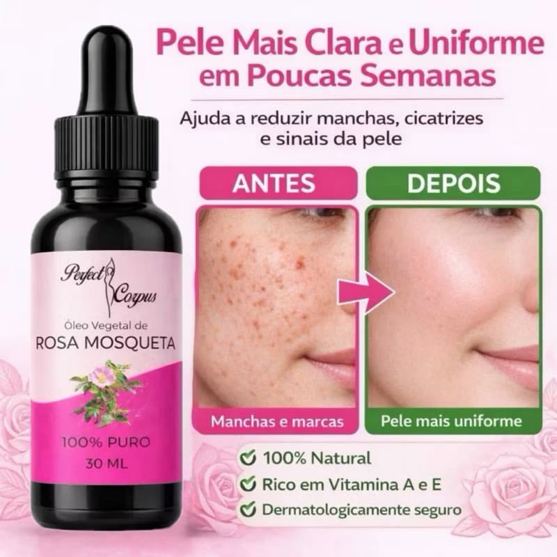 Óleo Vegetal de Rosa Mosqueta Rubiginosa 100% Puro Natural Prensado a Frio 30ml