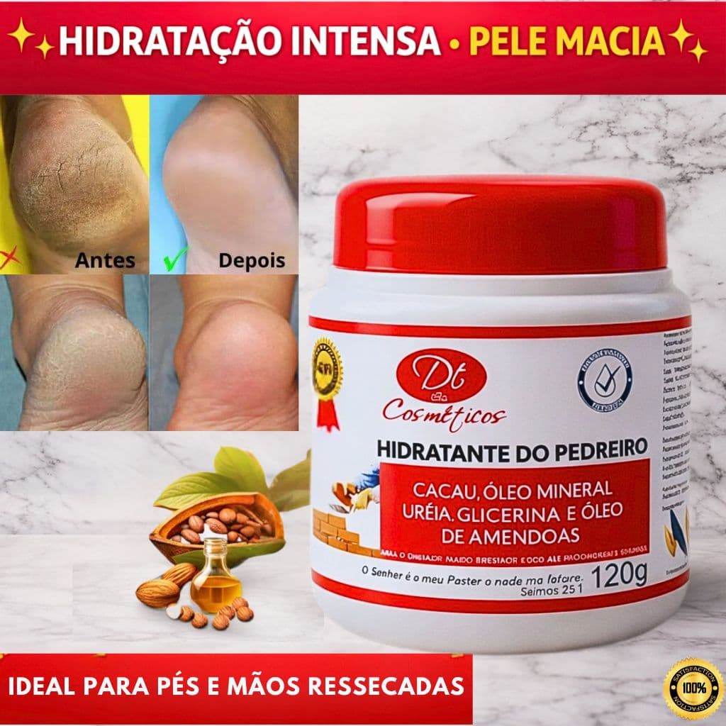 Hidratante do Pedreiro com Uréia Cacau Glicerina Para Pele Seca Rachada Áspera Hidratação Para Mãos Pés Cotovelos Grosso