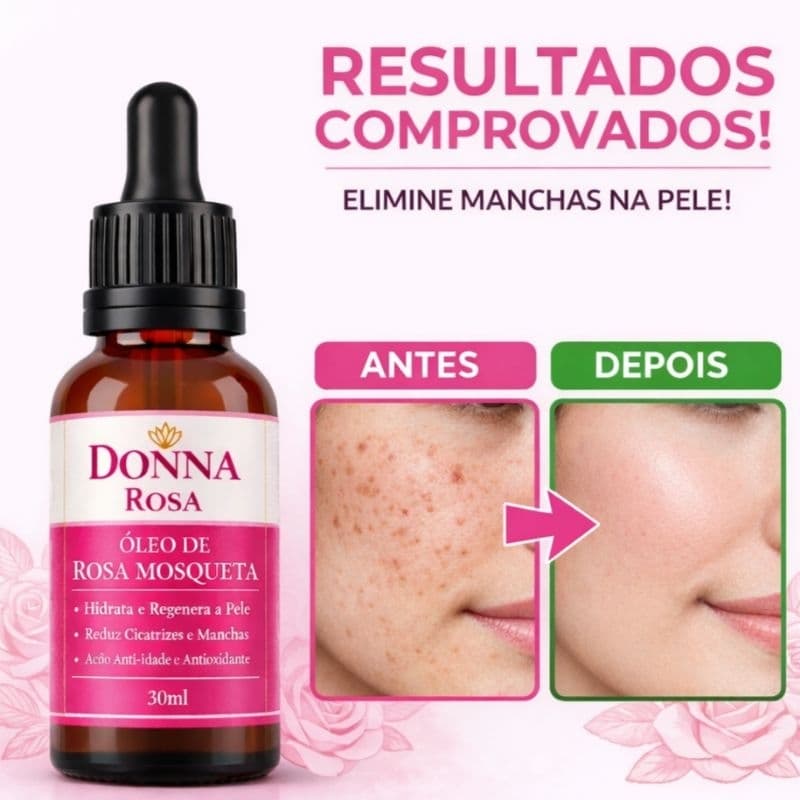 Óleo Rosa Mosqueta Rubiginosa 30ml 100% Puro – Clareador, Anti Manchas, Anti-Idade, Regenerador