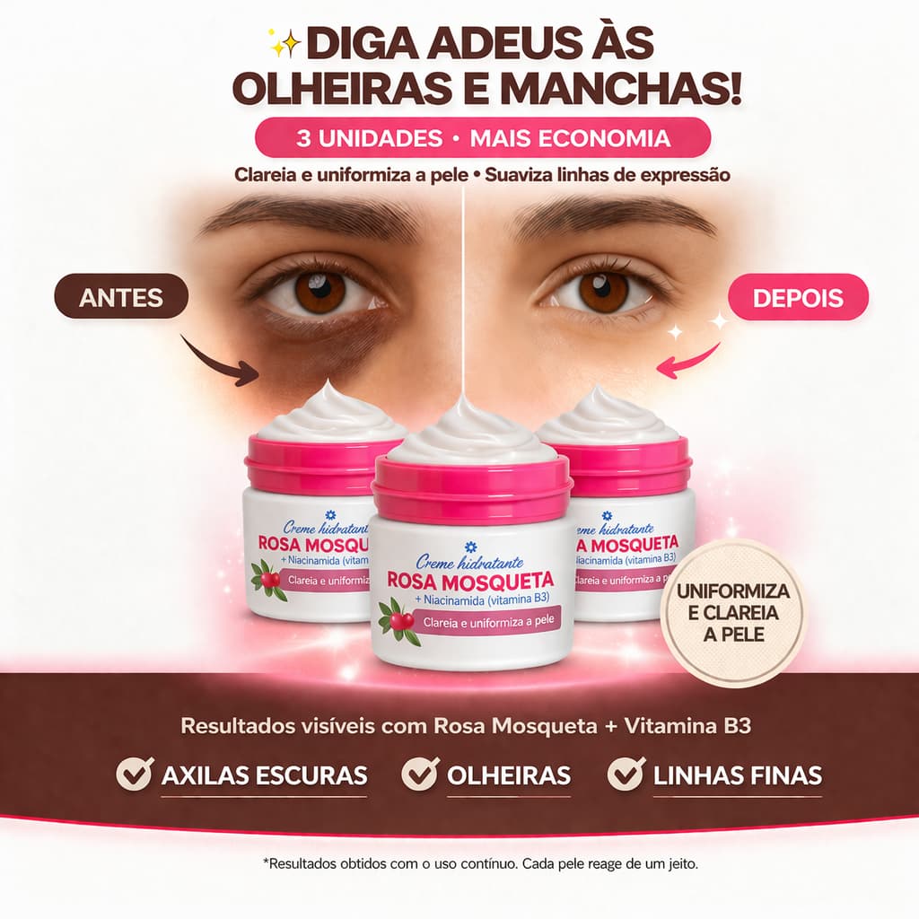 Kit 3 Cremes Rosa Mosqueta com Niacinamida – Clareador, Hidratante e Regenerador da Pele