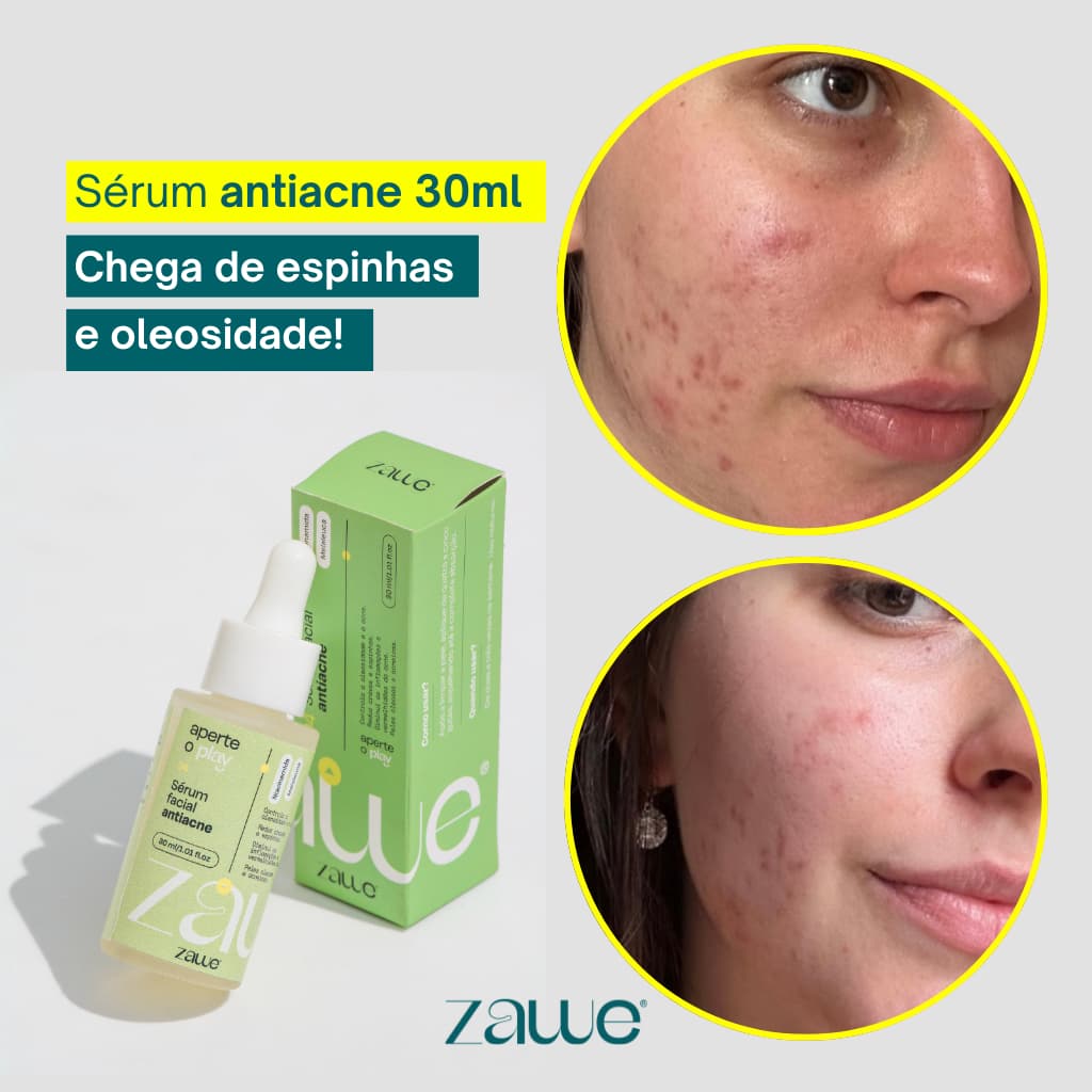 Serum Facial skincare antiacne cravos espinhas e vermelhidão 30ml