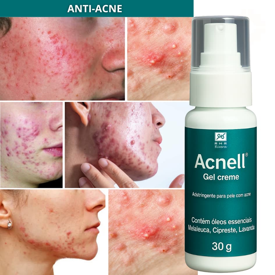 Remédio para Acne - Acnell 30gr