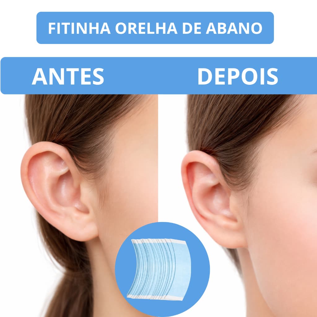 Fita Corretora de Orelha Invisível Extra Forte Mini Abas Discreta Confortável