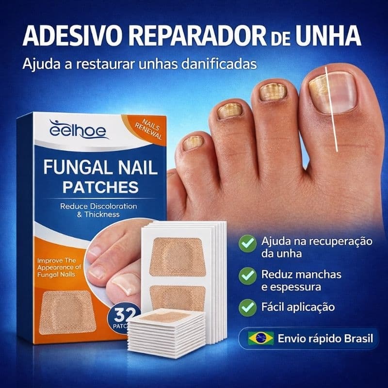 Kit Adesivo Reparador de Unhas dos Pés Cinza Fungo Unha Espessa Correção de Unhas das Mãos Infecção Paroníquia