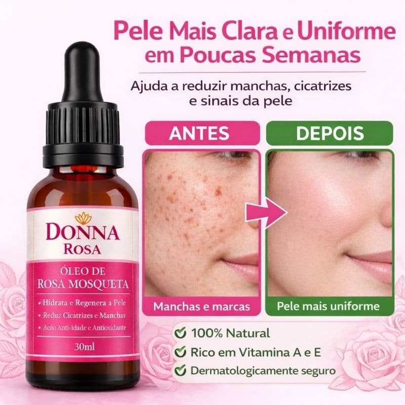 Óleo Vegetal de Rosa Mosqueta Rubiginosa 100% Puro Donna