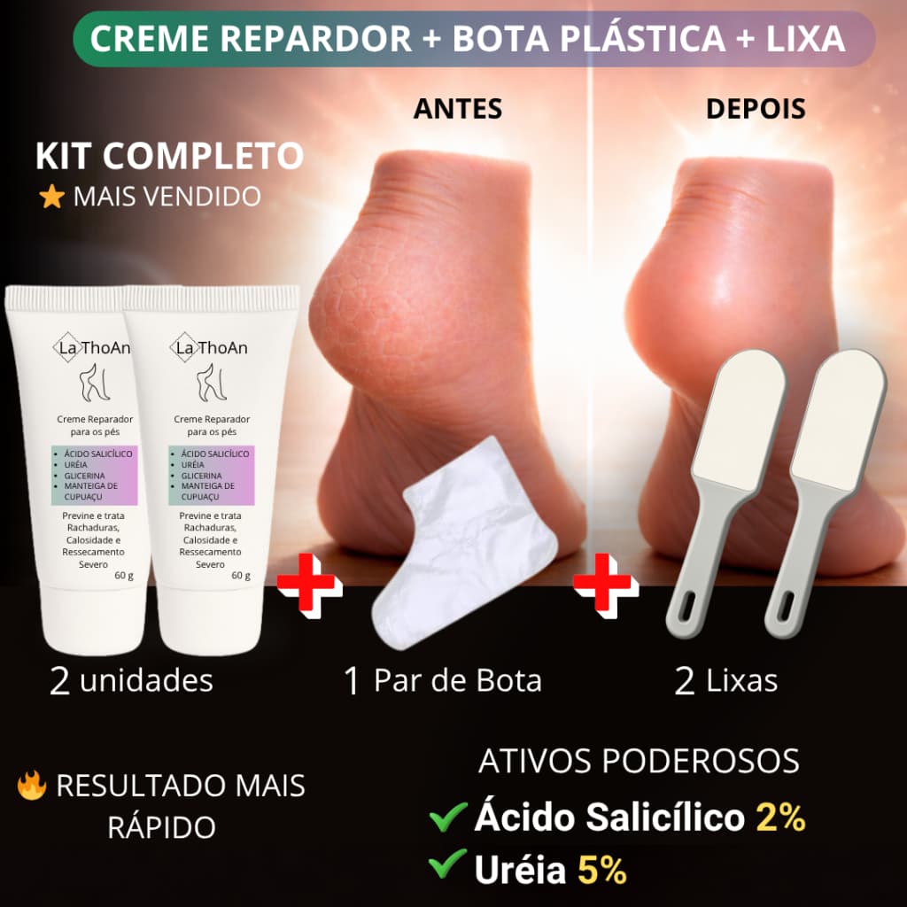 Creme para Pé Rachado e Grosso | Hidrata, Amacia e Afina os Pés + Kit Completo com Bota e Lixa