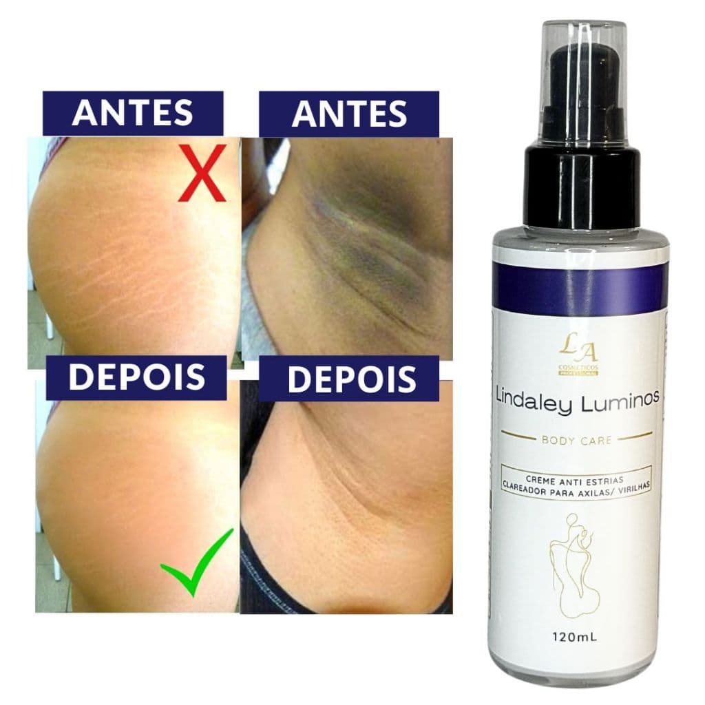 Lindaley Luminos - Anti Estrias - Clareador de Axila, Virilha, Joelhos 120ml - Entrega rápida