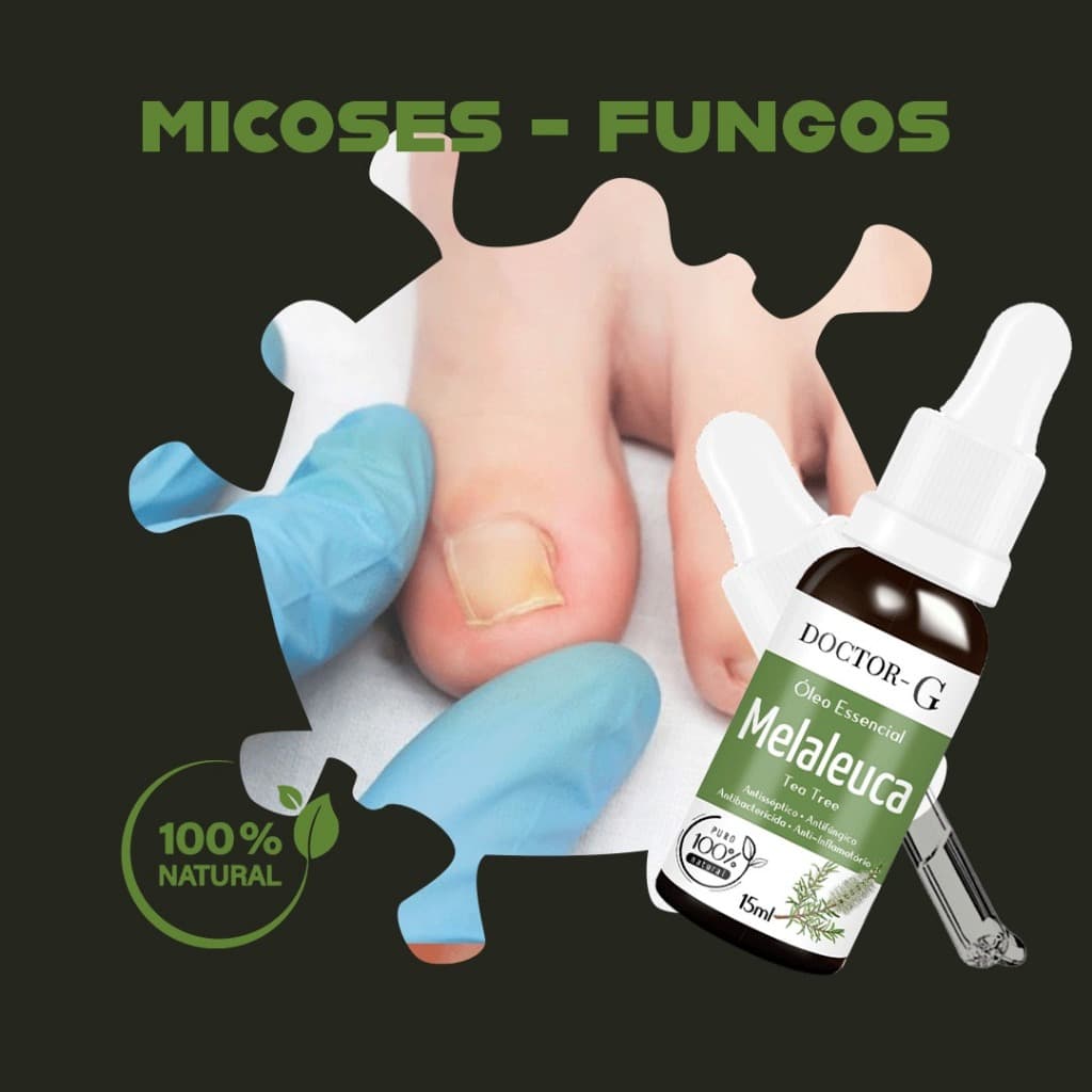 Oleo Essencial Melaleuca 100% Puro Australiano Tea Tree 15ML- DOCTOR-G