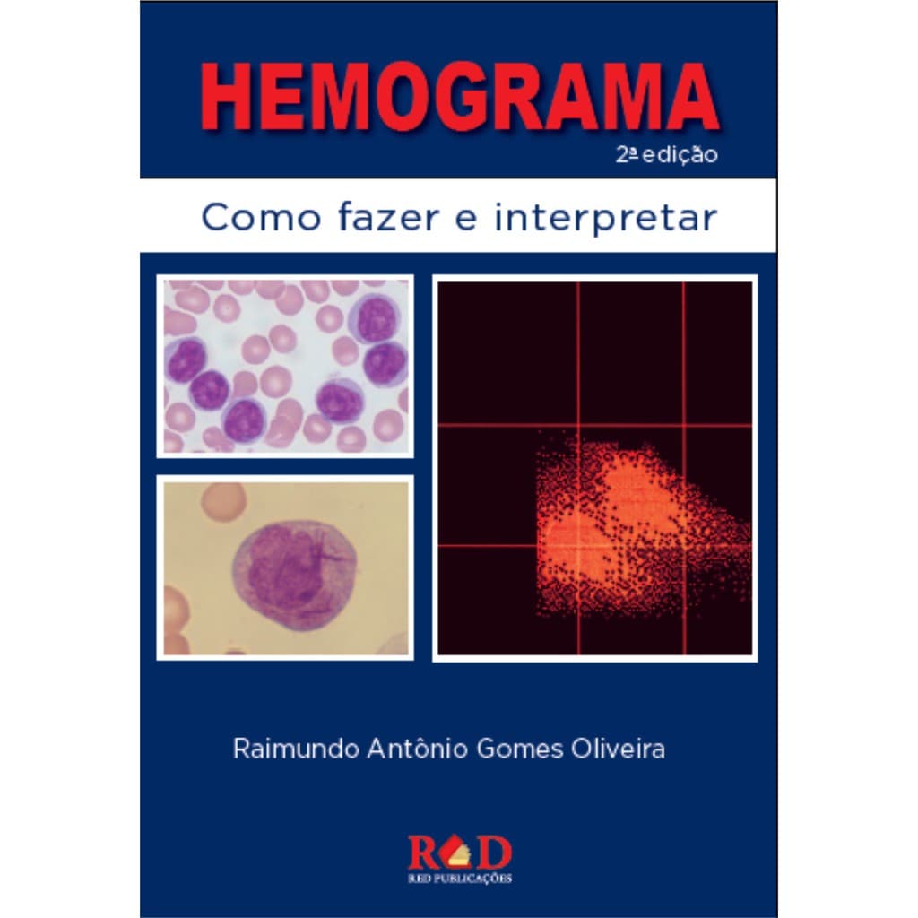 LIVRO HEMOGRAMA - Como fazer e interpretar 2ª edição