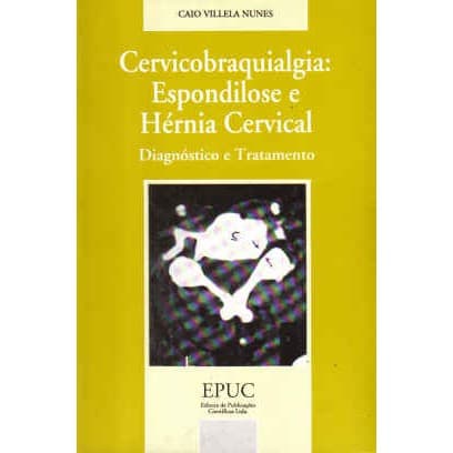 Cervicobraquialgia: Espondilose e Hérnia Cervical - Caio Villela Nunes