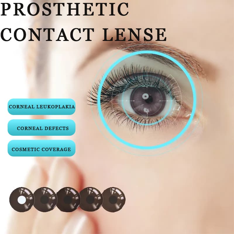 Lente De Contato Protética MILL CREEK 14.0MM 2PCS Uso Anual F1/F2/F3 Natrual