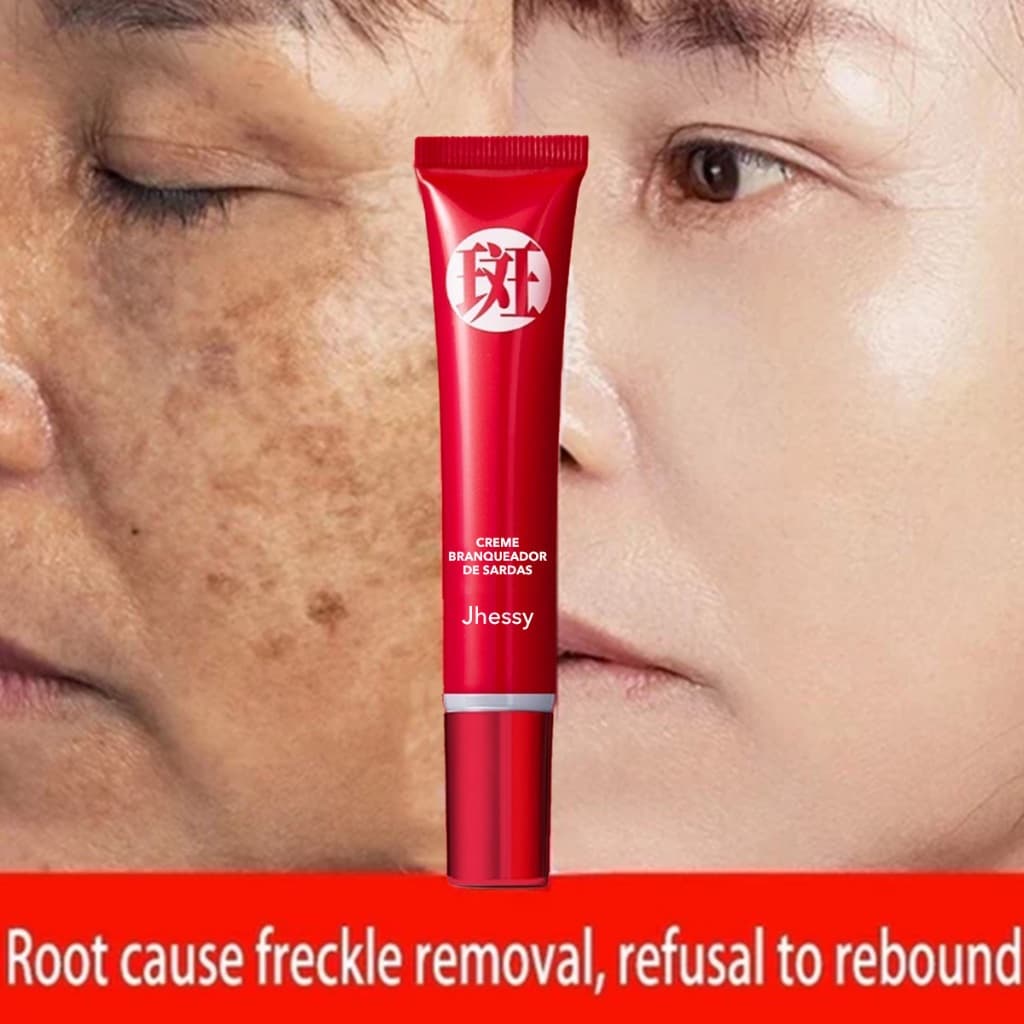 Creme clareador para remoção de sardas, hidratante e iluminador do tom da pele, reduz marcas de Acne