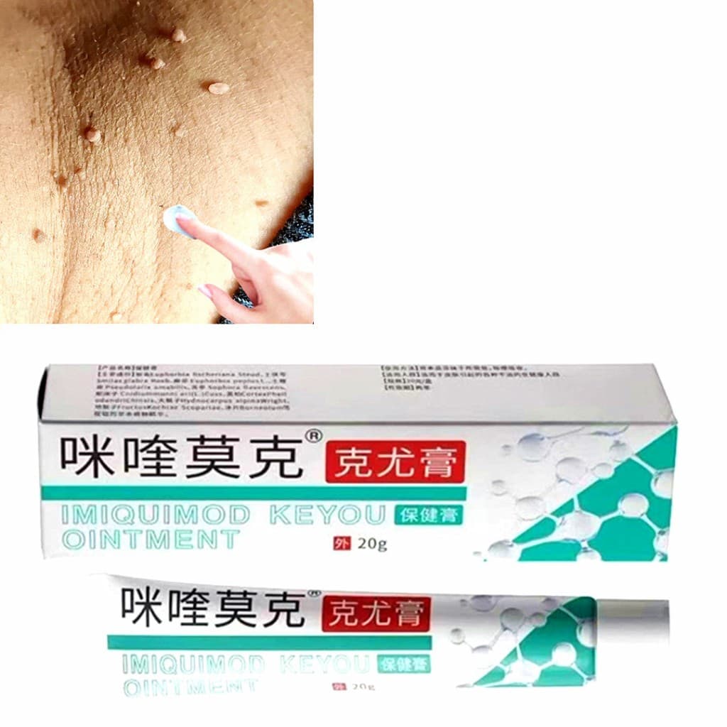 20g Creme para Verrugas no Pescoço: Diz Adeus aos Acrocórdons! Solução Específica para Verrugas Filiformes e Planas