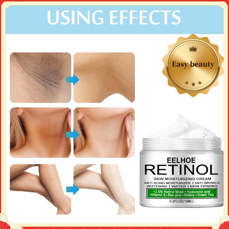 Creme De Clareamento Corporal , Peças Parlaulares , Soro Para Axilas , Joelho Brilhante , Parte Interna Da Coxa , Escuro