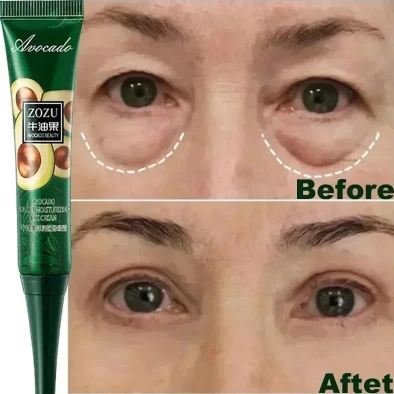 Creme Instantâneo Antirrugas Para Os Olhos , anti-Olheiras , Bolsas E Produtos Inchados Cuidados Com A Pele .