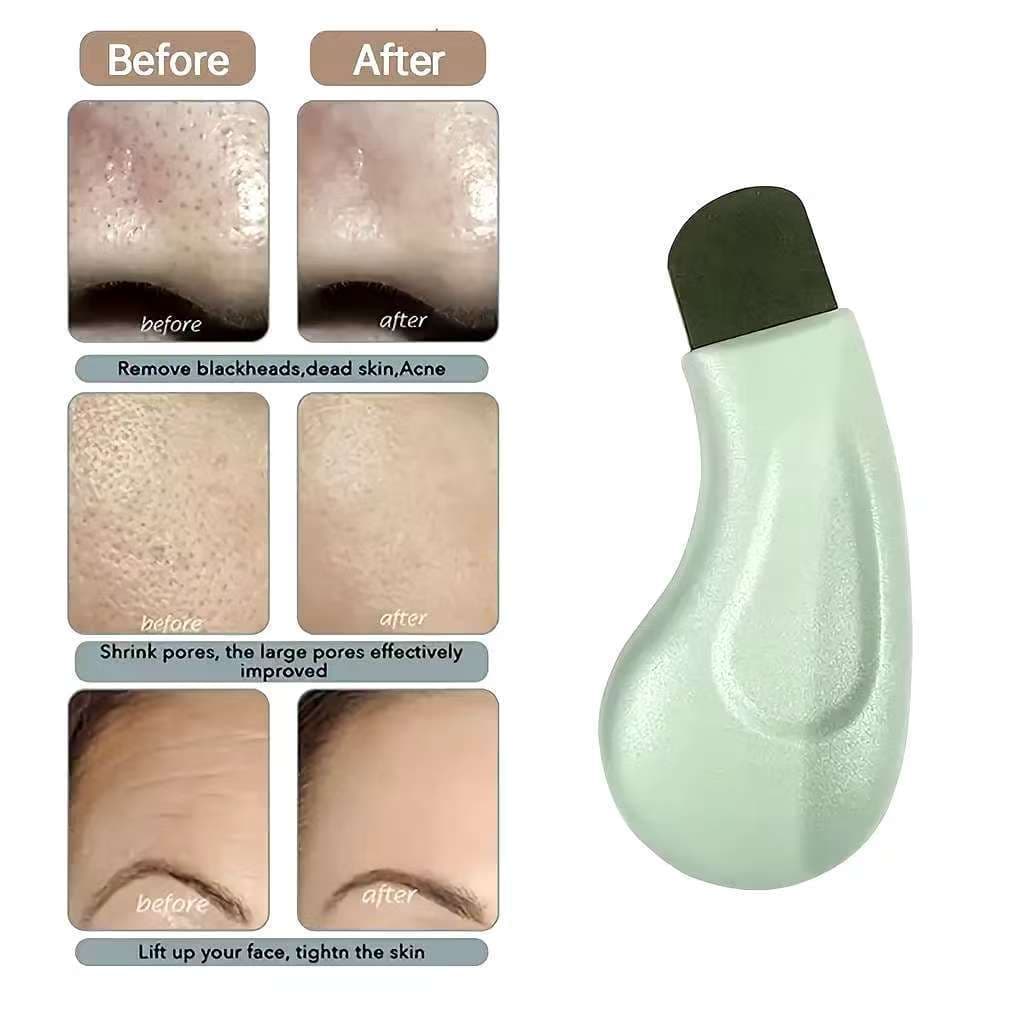 1 Pçs Profissional Nariz Limpeza Profunda Cravo Espinha Ferramenta De Remoção Rosto Esfoliante Espátula Poros Mais Limpo