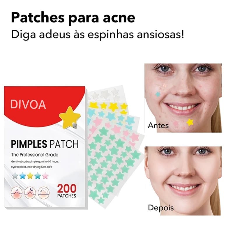 200pcs Acne Patch Adesivo Para Espinha Pimple Patch Estrela Desbotar Hidrocoloide Acne Master Patch Adesivo Para Acne