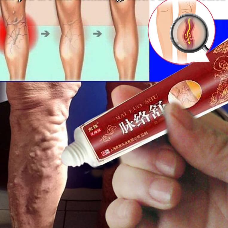 Creme / Pomada Para Tratamento De Veias Varizes 1 Pçs 20g