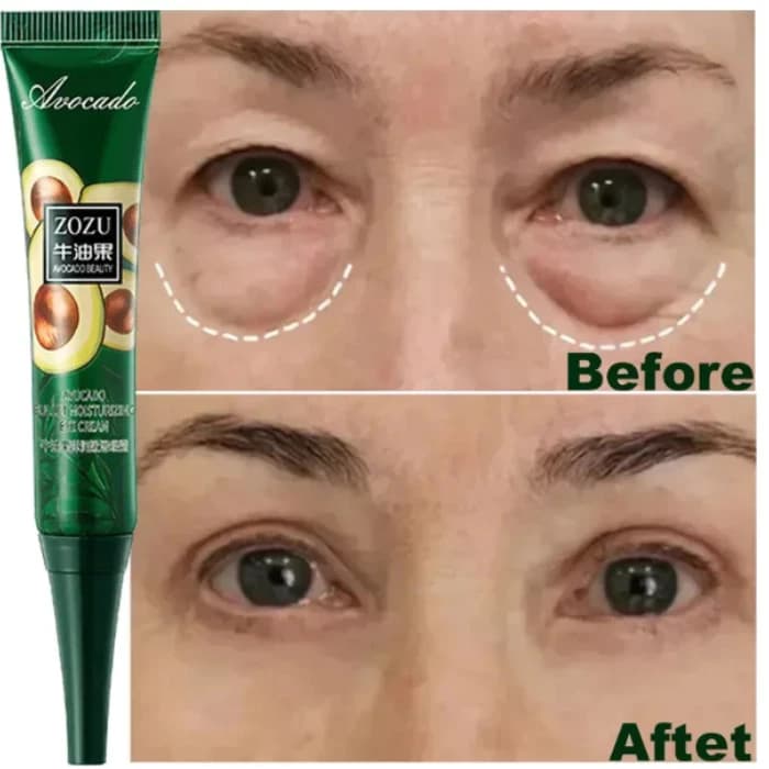 Creme instantâneo anti-rugas para os olhos, anti-olheiras, bolsas nos olhos e produtos para o cuidado da pele com inchaç