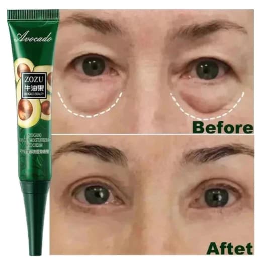 Creme Instantâneo Antirrugas Para Os Olhos , Anti-Olheiras , Bolsas E Inchaço , Produtos Cuidados Com A Pele