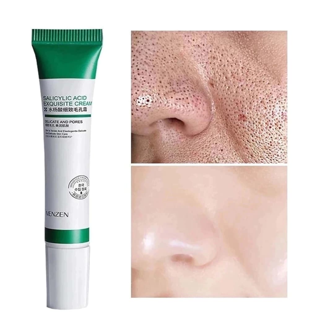 Creme De Ácido Salicílico Para Redução De Poros , Hidratação E Nutrição Da Pele-Hidratante Refinador Loção Facial , Cuid