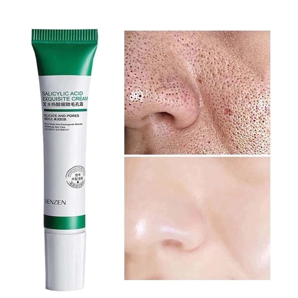 Creme Facial Antiacne 20ml | Desobstrutor de Poros, Redutor de Cravos e Espinhas, Controle da Oleosidade e Ação Clareado