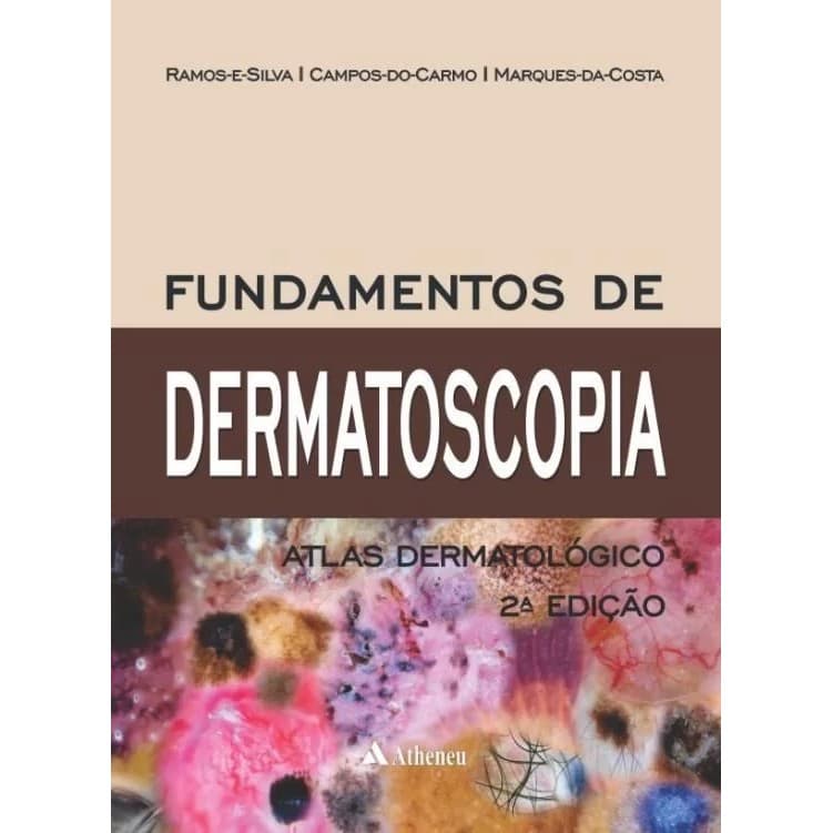 FUNDAMENTOS DE DERMATOSCOPIA ATLAS DERMATOLÓGICO