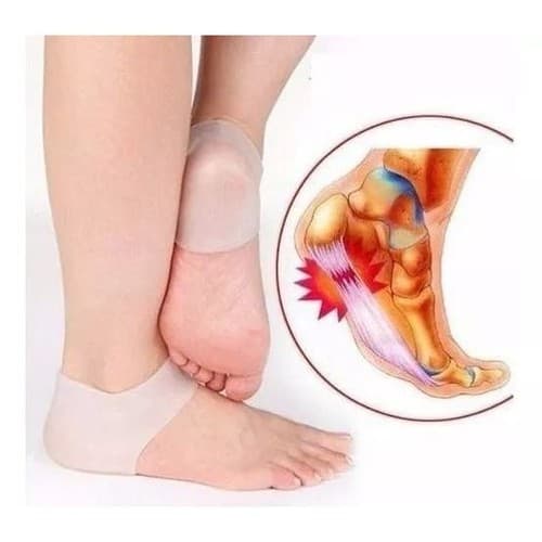 Palmilha Ortopédica Fascite Plantar, Esporão Ósseo Calcanhar