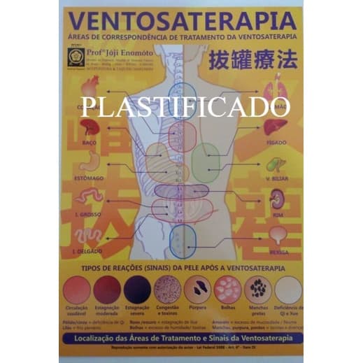 Mapa De Ventosaterapia A4 Prof Jóji Enómoto Plastificado