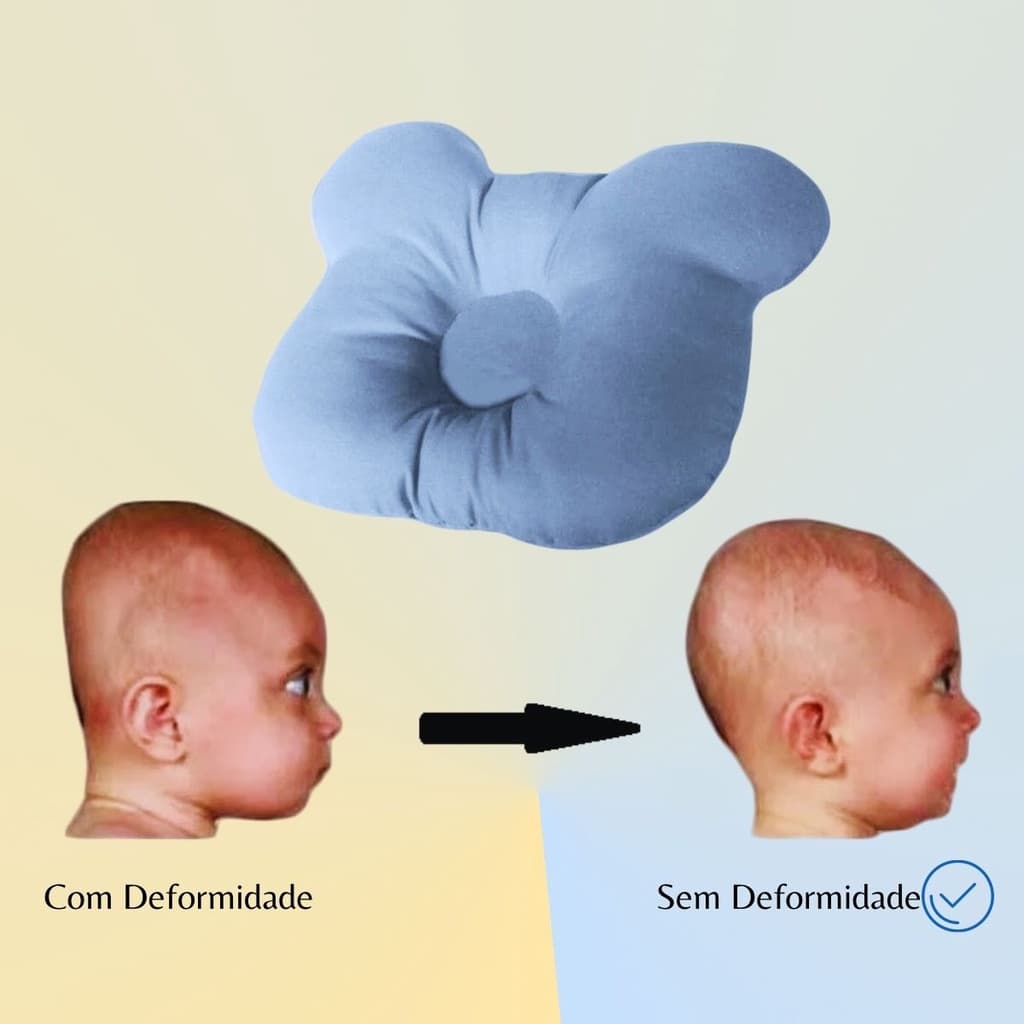 Travesseiro Plagiocefalia Cabeça Amassada Do Bebê