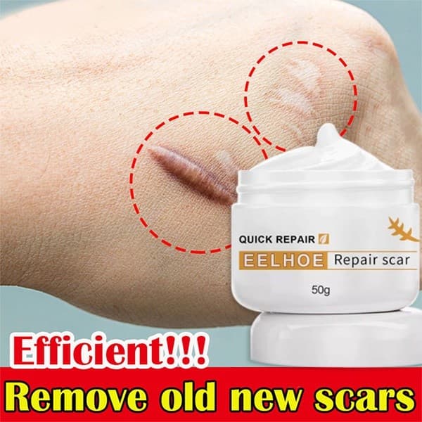 Removedor De Cicatrizes Antigas 50g Para Gel Reparador De Estiramento De Acne Peklat