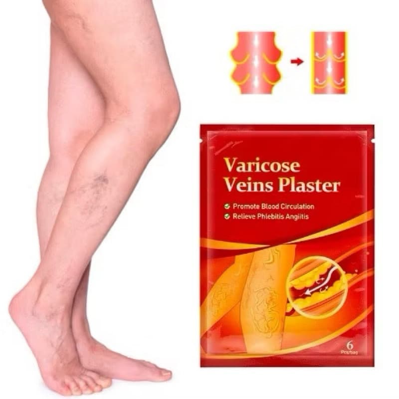 Kit Adesivo Auxilia Nas Varizes Vasos E Veias Auxiliando na Saúde das Pernas