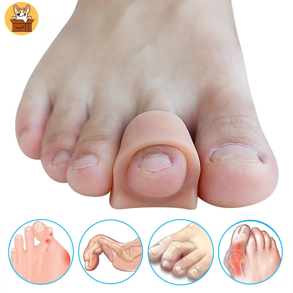 【 Am-az 】 2Pcs Separadores De Dedo Do Pé Em Gel Macio Espaçadores Para Sobreposição Da Ferramenta Hallux Valgus E Hammertoe Foot Care