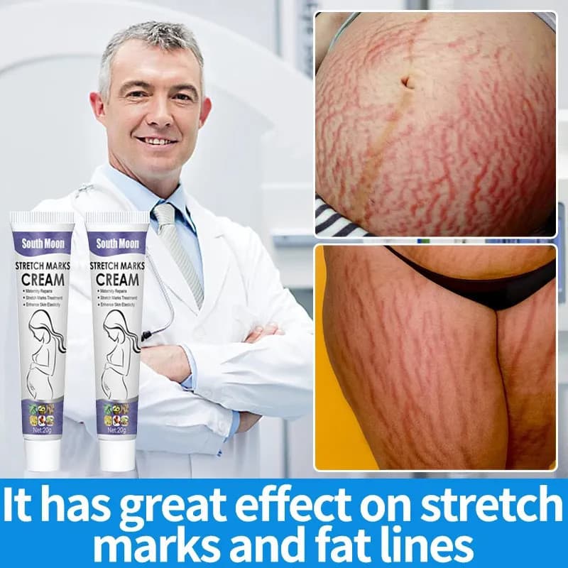 Stretch Marks Creme De Remoção Permanente Eliminar Marcas De Estrias Do Corpo Inchaço Remover Rachaduras Na Pele